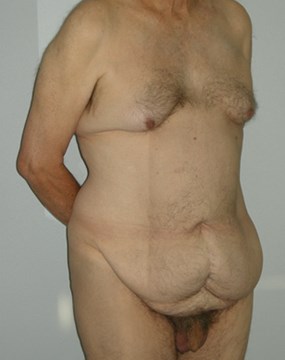 Bariatrics-7.jpg