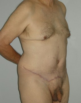 Bariatrics-8.jpg