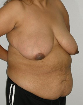 Bariatrics-22.jpg